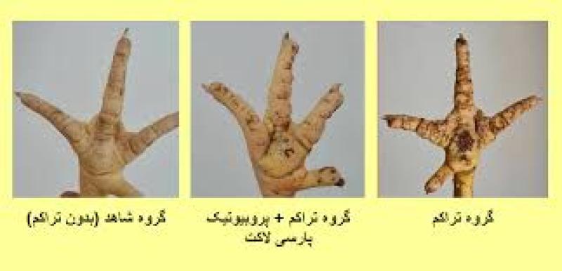 درماتیت پد پا